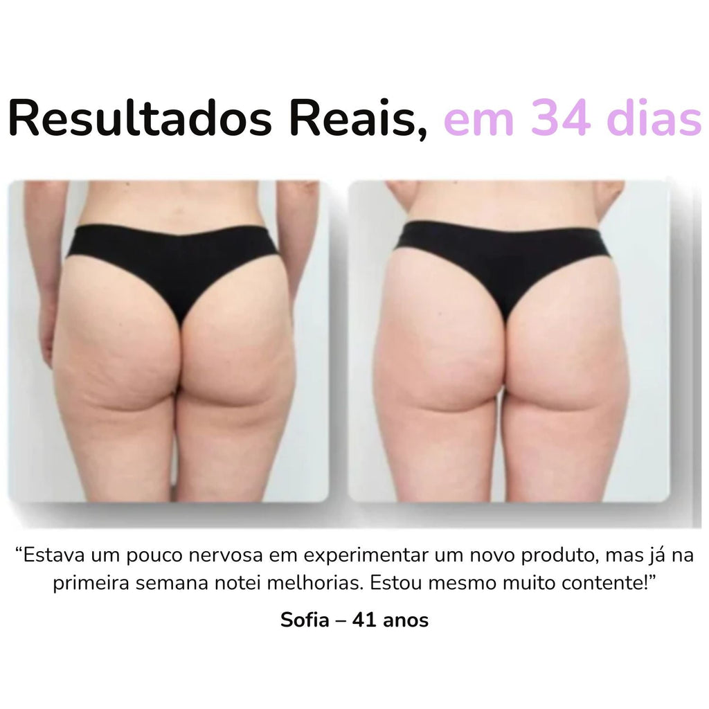 Massageador Anticelulite Pro + 2 Óleos  de brinde
