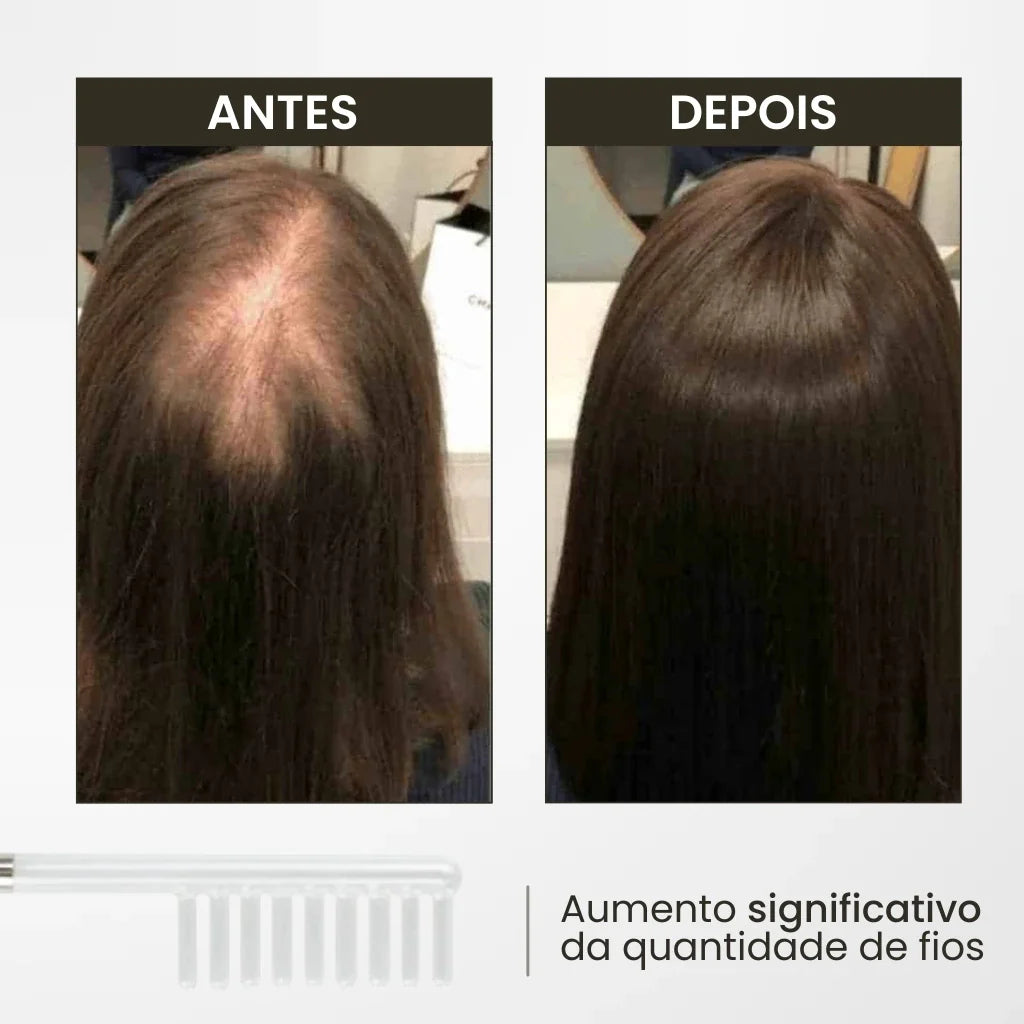 Escova de Alta Frequência: Inovação para Revitalização Capilar